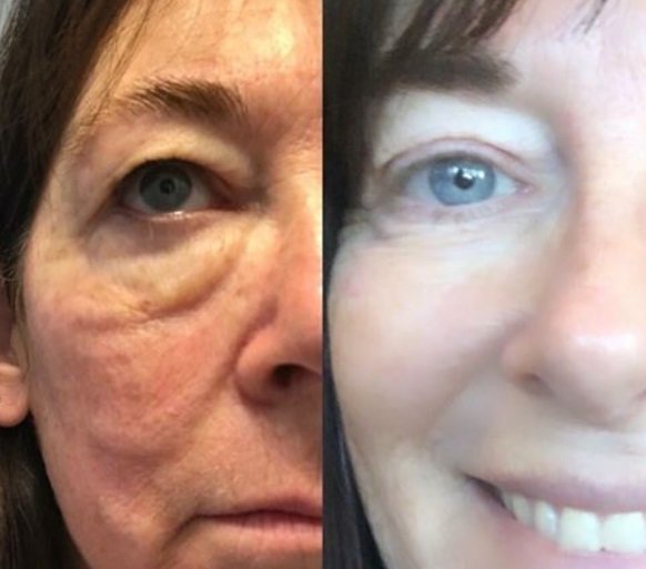 antiaging coach salon gold coast australia - Buy Modere Collagen Liquid BioCell, TRIM 15% Off CANADA - Where to buy Modere CellProof Skincare - Shaklee Ambassador antiaging coach salon gold coast australia