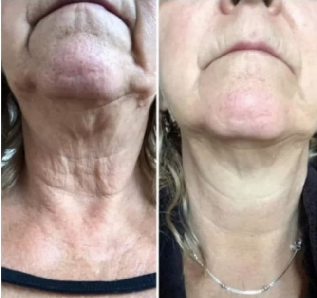 liquid biocell collagen - Buy Modere Collagen Liquid BioCell, TRIM 15% Off CANADA - Where to buy Modere CellProof Skincare - Shaklee Ambassador liquid biocell collagen